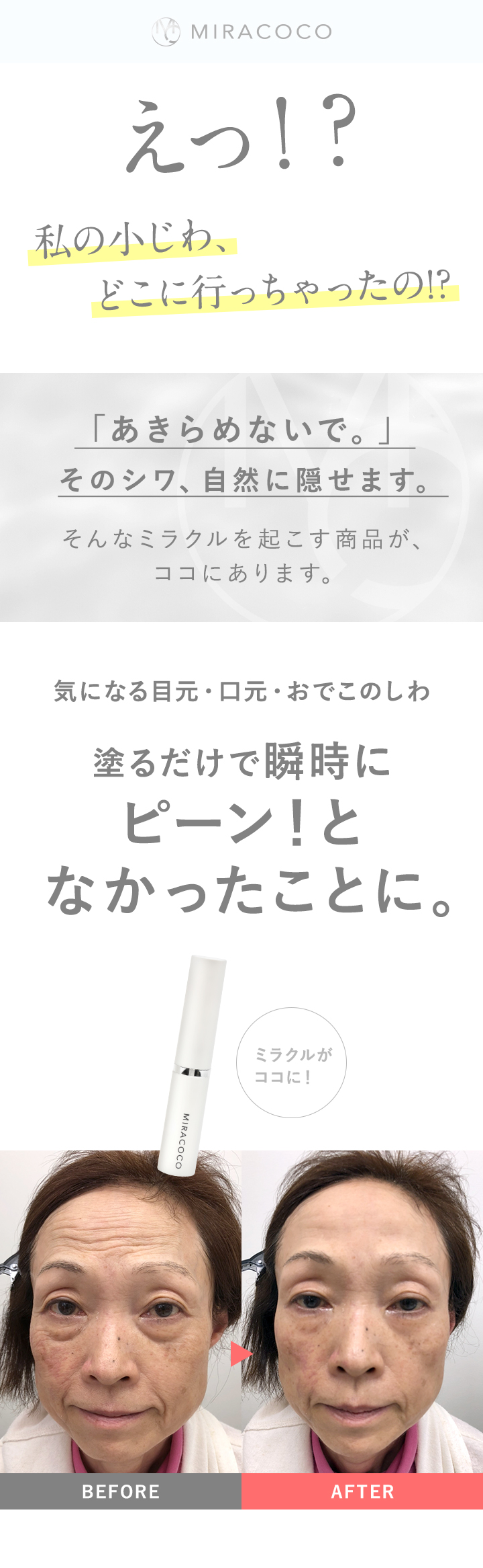 気になる目元・口元・おでこのしわ塗るだけで瞬時にピーン！となかったことに。