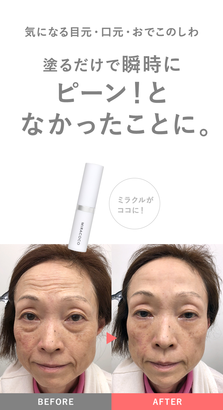 リンクルール 5g