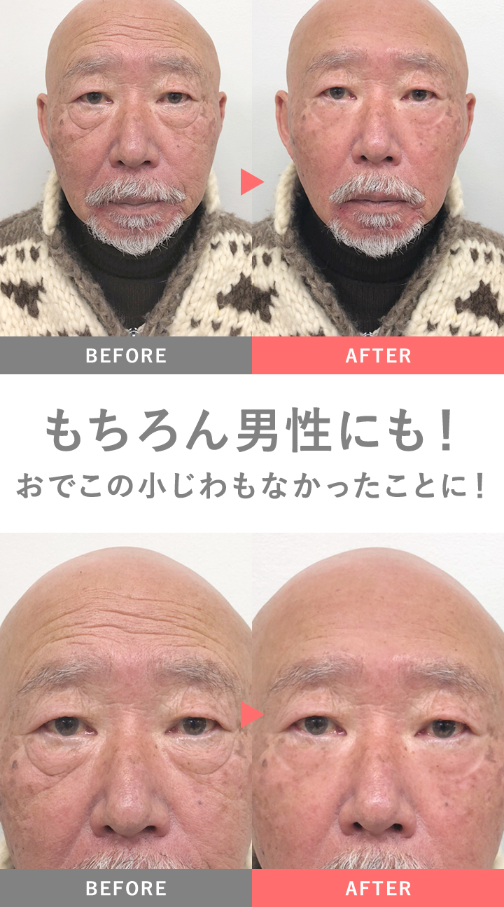 リンクルール 5g