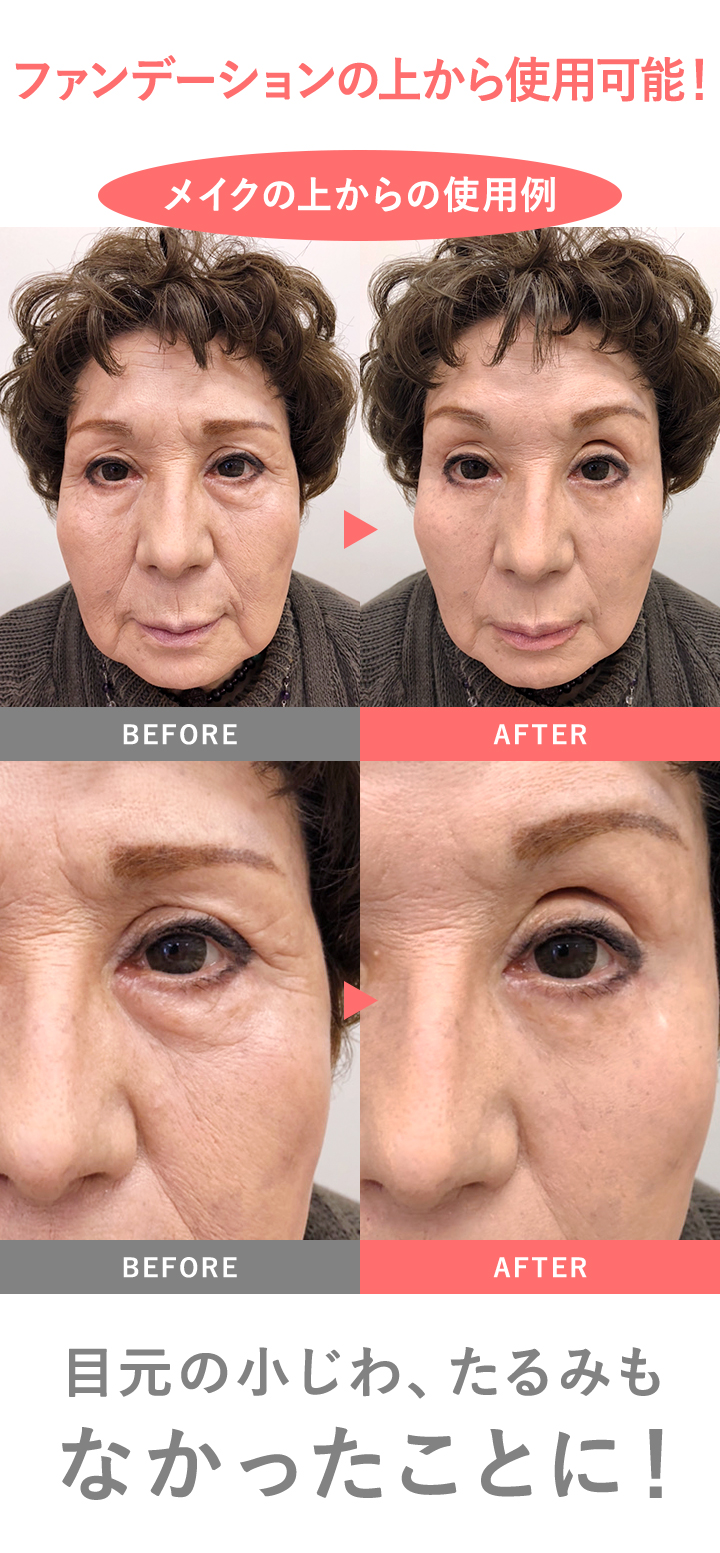 リンクルール 5g