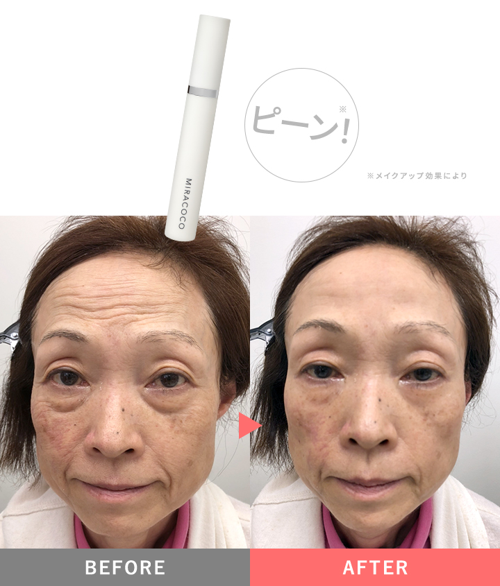 リンクルールプラス