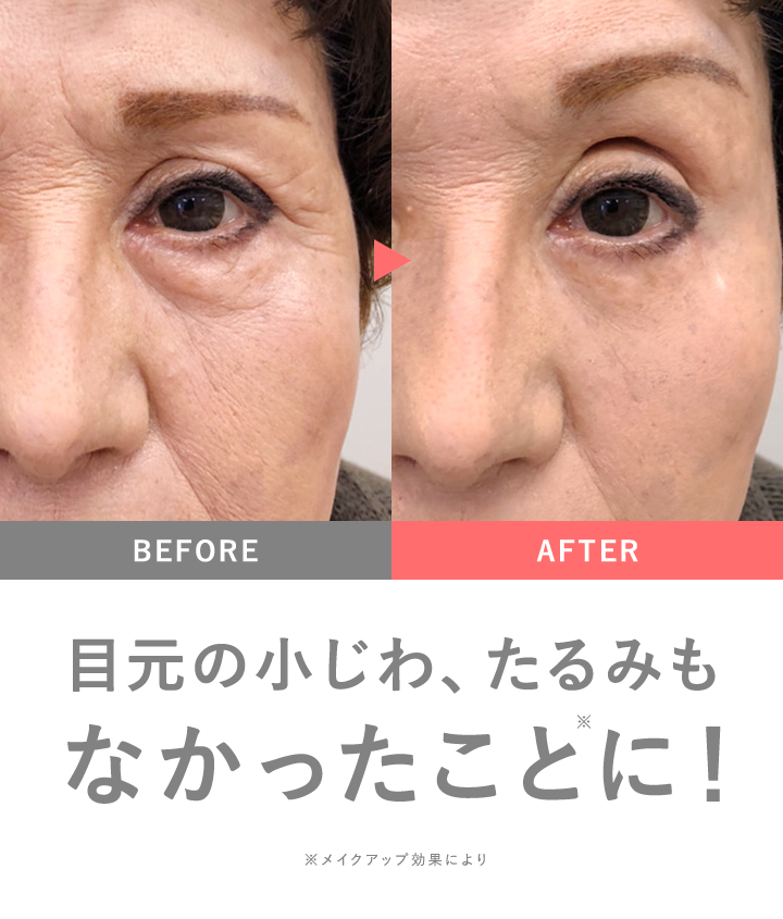 リンクルールプラス