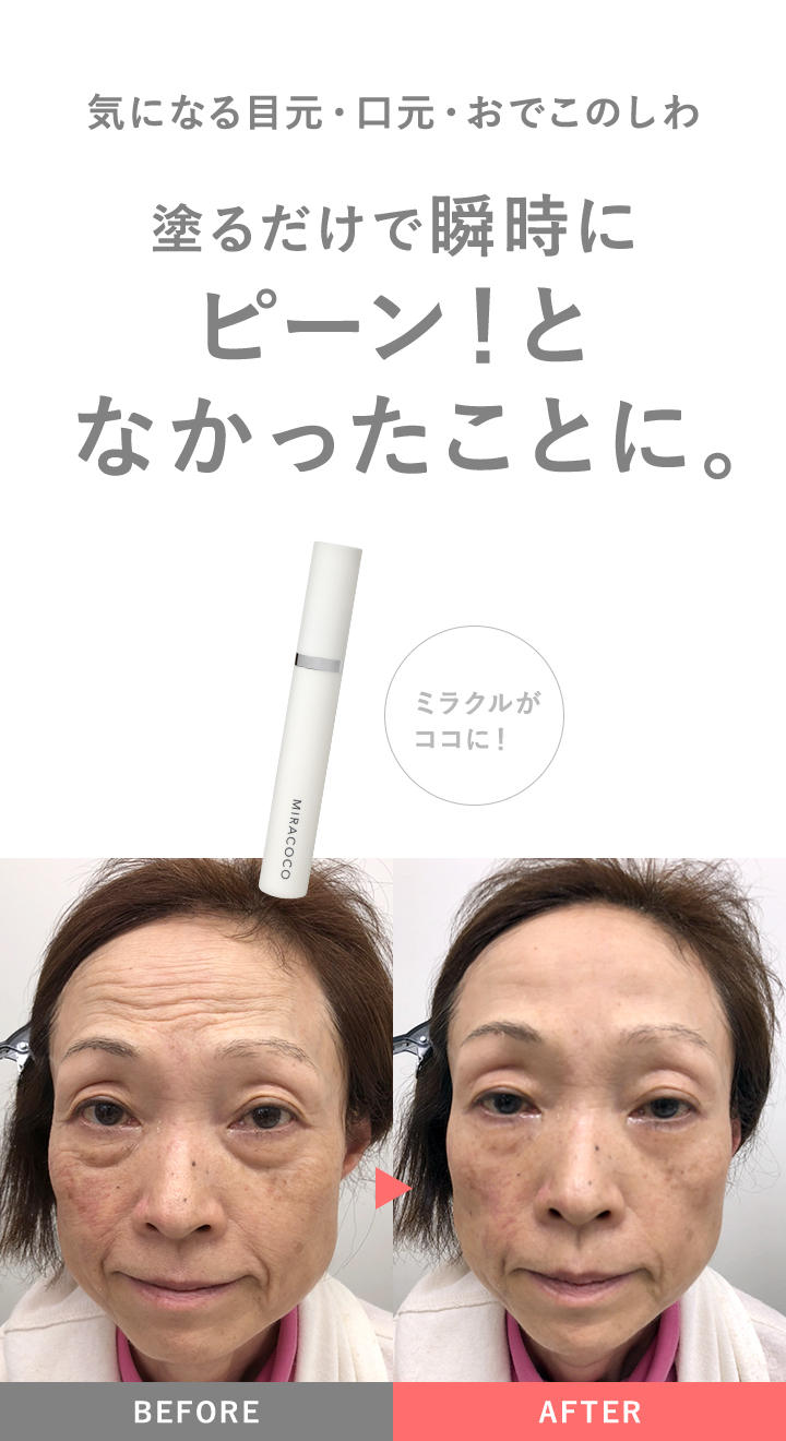 リンクルールプラス